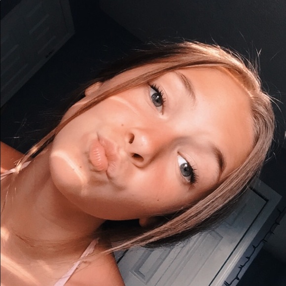 zoeglossup